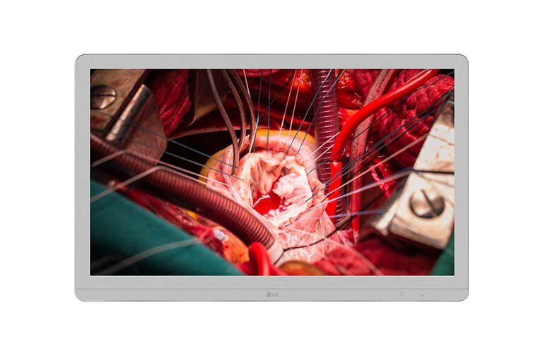 A(z) LG 27&#34; 27HJ710S 4K &amp; 5K UHD Orvosi monitor 27HJ710S-W elölnézete