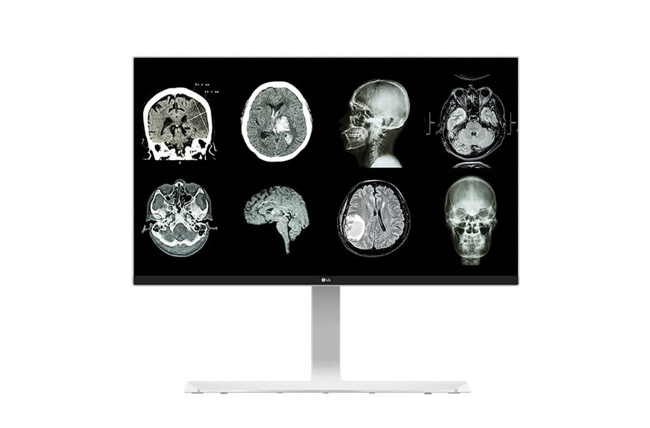 A(z) 27&#34; 27HJ712C 8MP-es Orvosi monitor 27HJ712C-W elölnézete