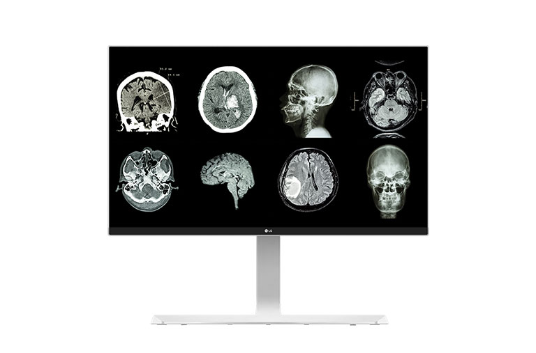 A(z) 27&#34; 27HJ712C 8MP-es Orvosi monitor 27HJ712C-W elölnézete