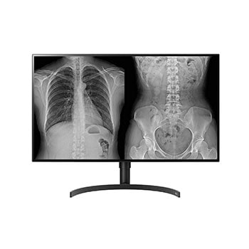 A(z) 32”-os 16:9 képarányú 8MP IPS orvosi monitor  32HL512D-M elölnézete