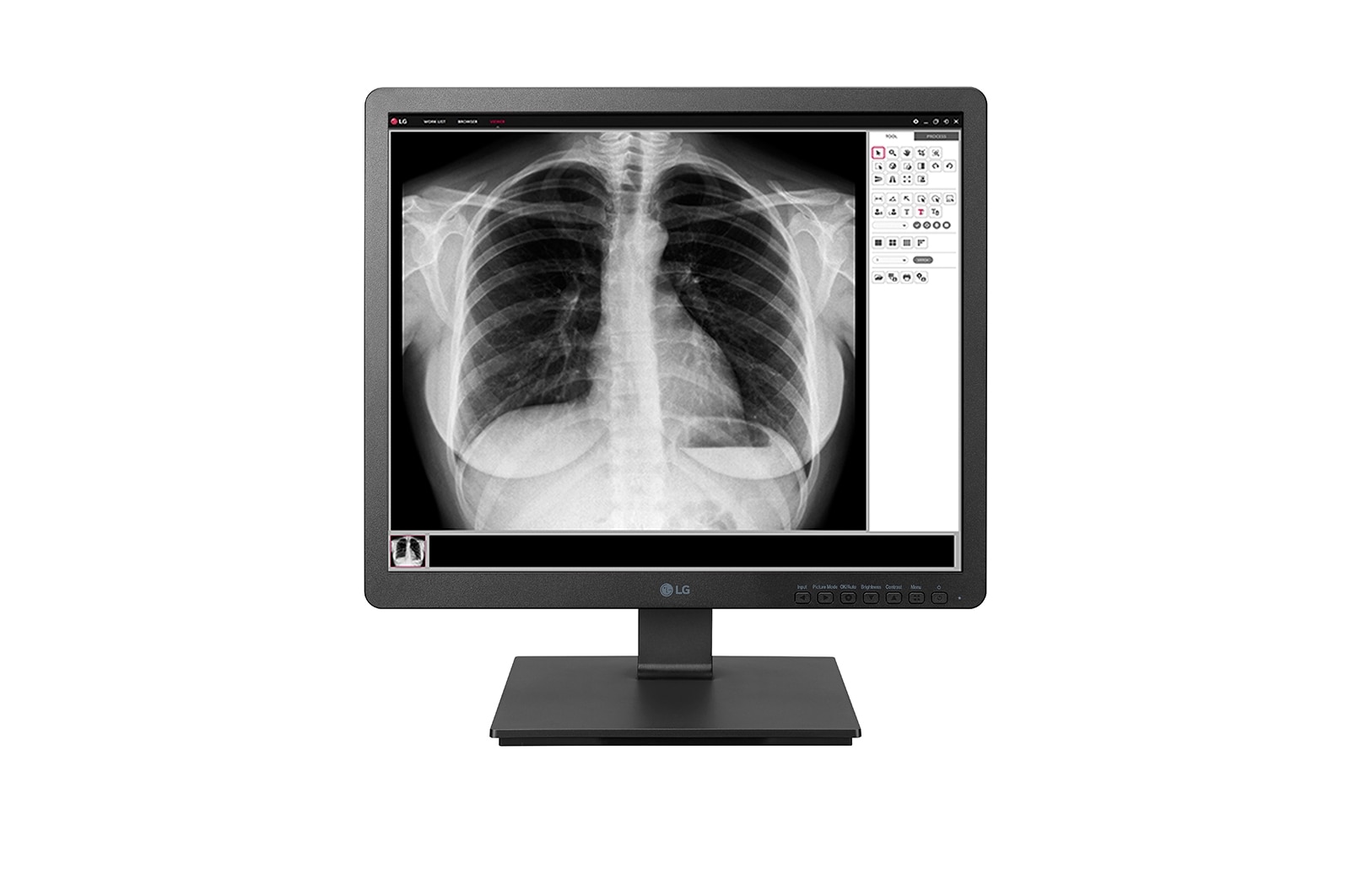 A(z) 19&#34; 1,3 MP-es klinikai ellenőrző monitor, 19HK312C 19HK312C-B elölnézete