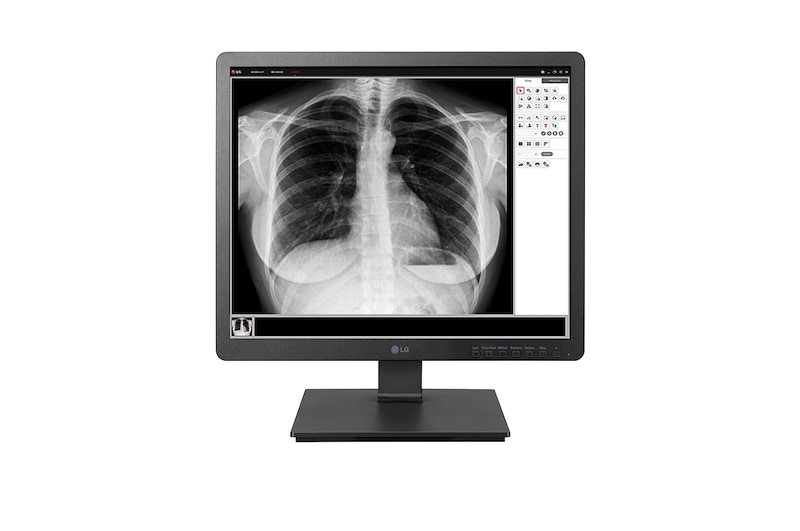 LG 19" 1,3 MP-es klinikai ellenőrző monitor, 19HK312C, 19HK312C-B