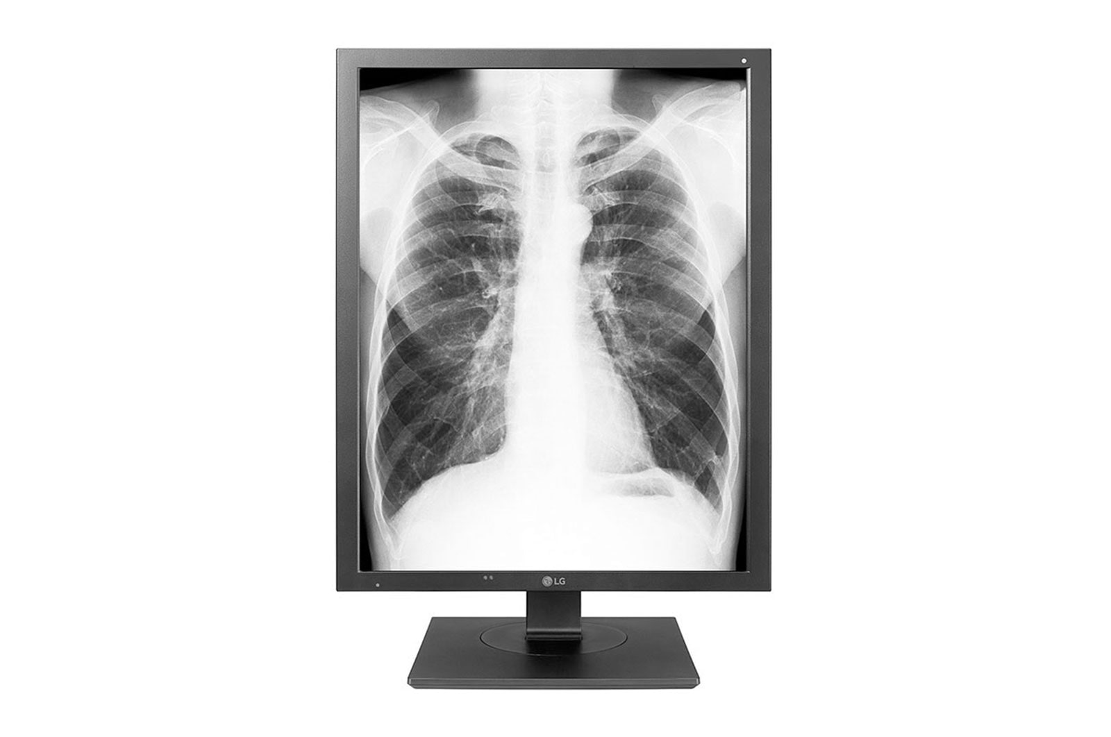 A(z) LG 21,3&#34; 3 MP felbontású diagnosztikai monitor 21HK512D-B elölnézete