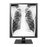 A(z) LG 21,3&#34; 3 MP felbontású diagnosztikai monitor 21HK512D-B elölnézete