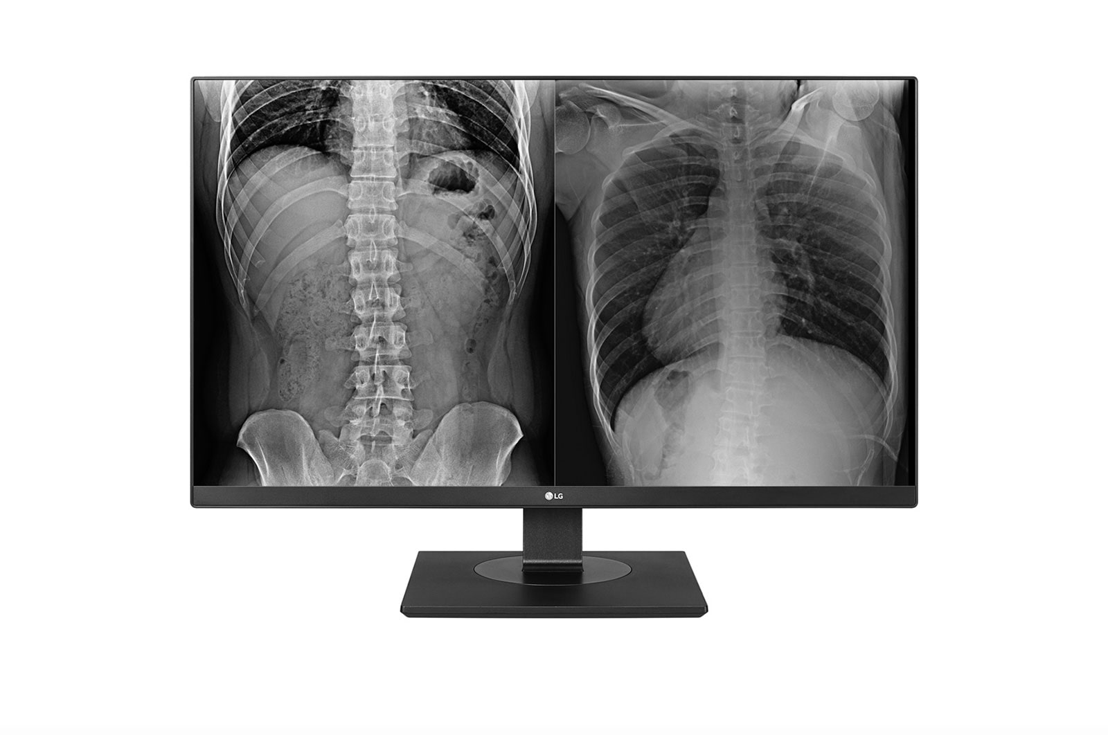 A(z) LG 27&#34; 8 MP felbontású klinikai ellenőrző monitor 27HJ713C-B elölnézete