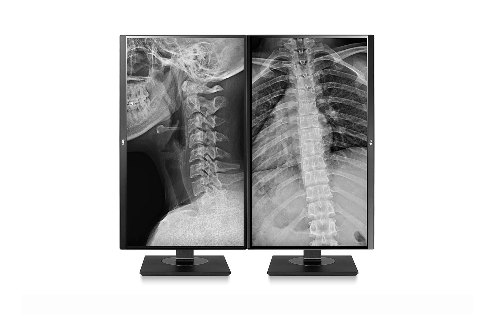 LG 27" 8 MP felbontású klinikai ellenőrző monitor, 27HJ713C-B
