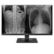 A(z) LG 27&#34; 8 MP felbontású klinikai ellenőrző monitor 27HJ713C-B elölnézete
