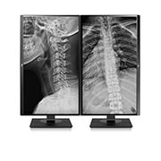LG 27" 8 MP felbontású klinikai ellenőrző monitor, 27HJ713C-B