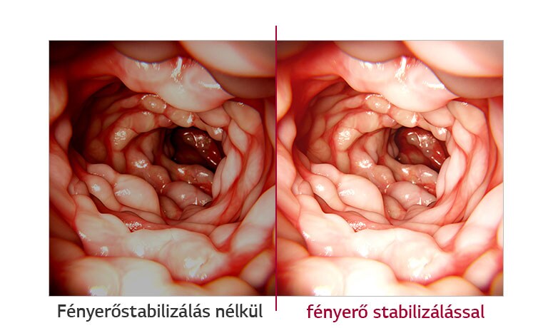 Fényerőstabilizálás nélkül vs. fényerő stabilizálással