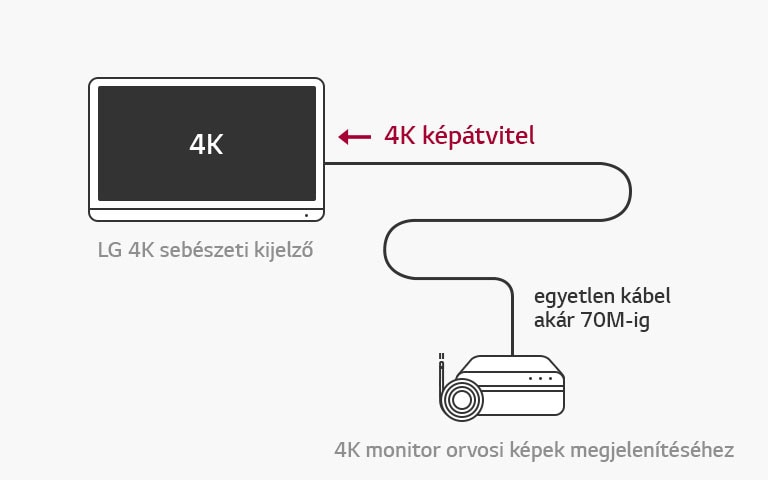 12G-SDI támogatás: az LG 4K sebészeti kijelző lehetővé teszi a képek 4K felbontású, késleltetés nélküli átvitelét egyetlen kábelen kersztül a stabil műtétekhez.