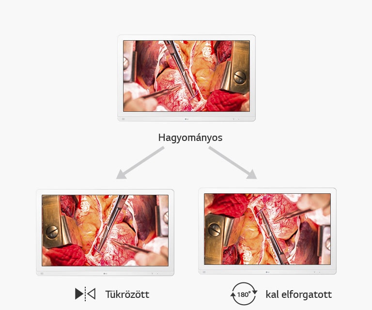Hagyományos, tükrözött és 180°-kal elforgatott kijelző