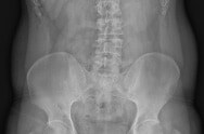 X-ray image 3 X-ray image 3