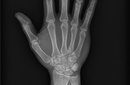 X-ray image 4 X-ray image 4