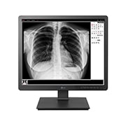 19&#34; medical monitor  19HK312C-B tampak depan