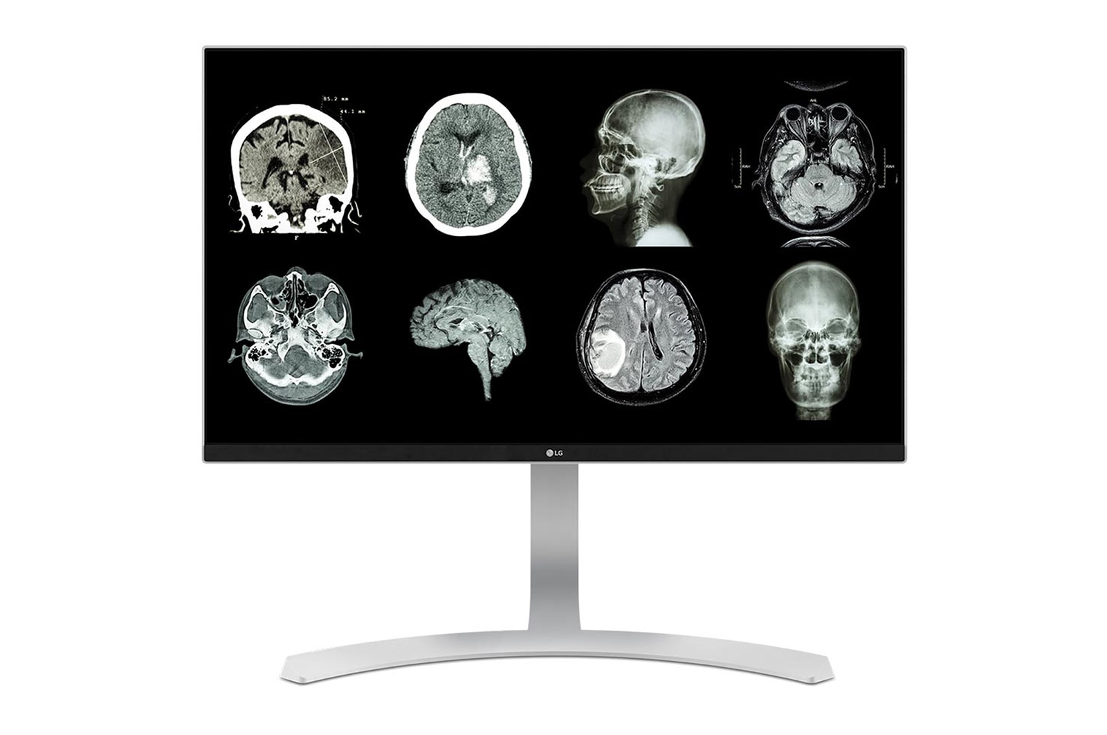 LG 27" LG Monitor Kajian Klinis 8MP , 27HJ712C-W