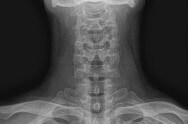 X-ray image 1. X-ray image 1.