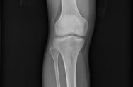 X-ray image 5 X-ray image 5