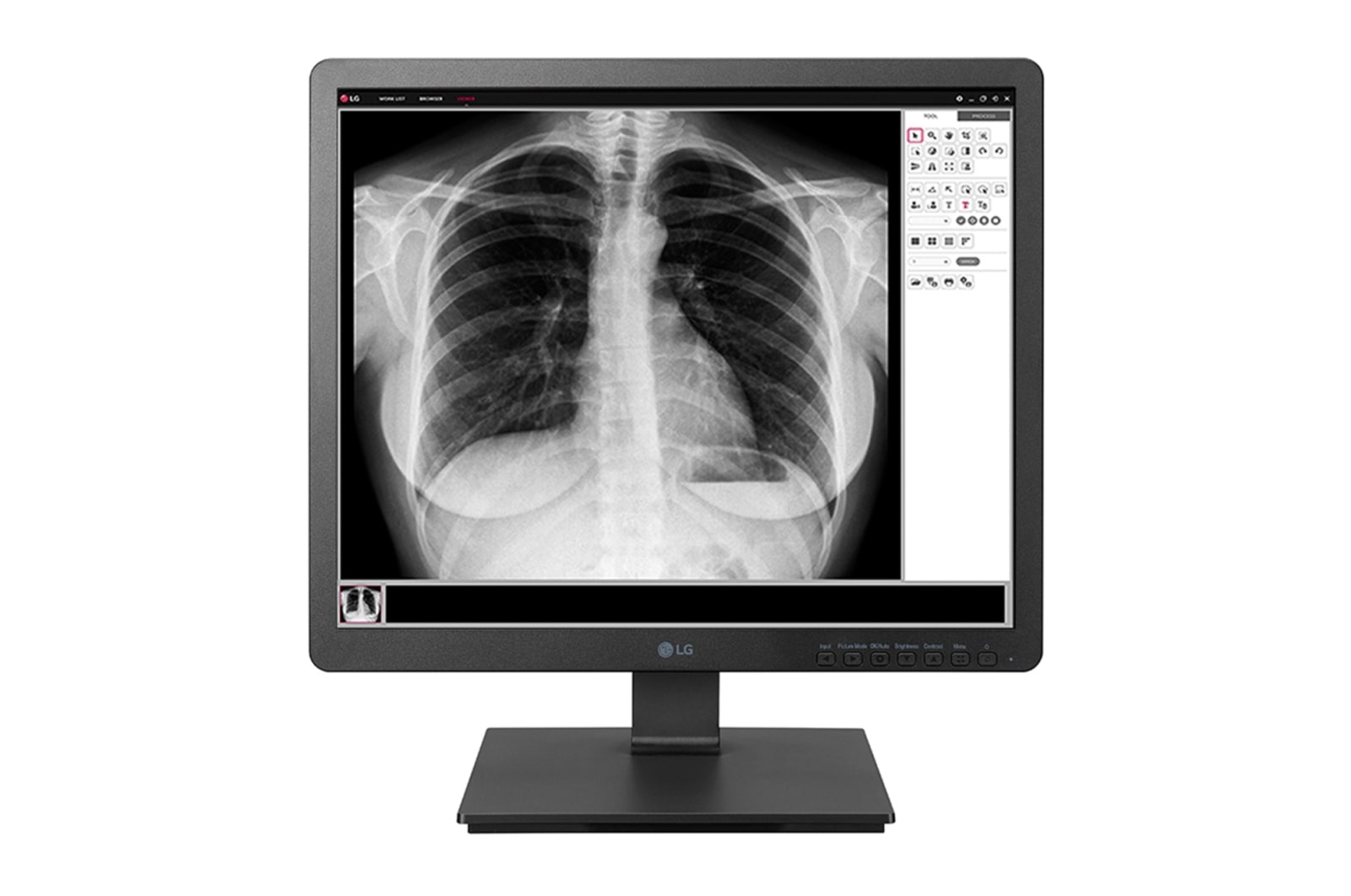 19&#34; medical monitor  19HK312C-B tampak depan