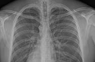 X-ray image 2 X-ray image 2