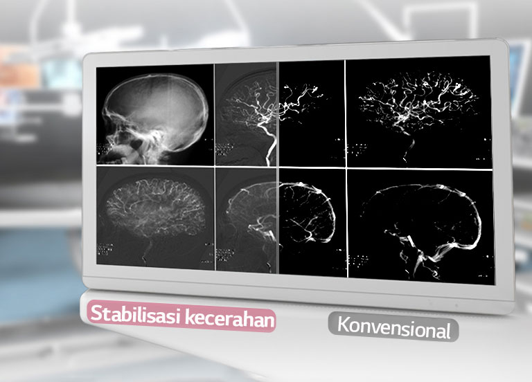DICOM Part 14 &<br>Brightness Stabilization1