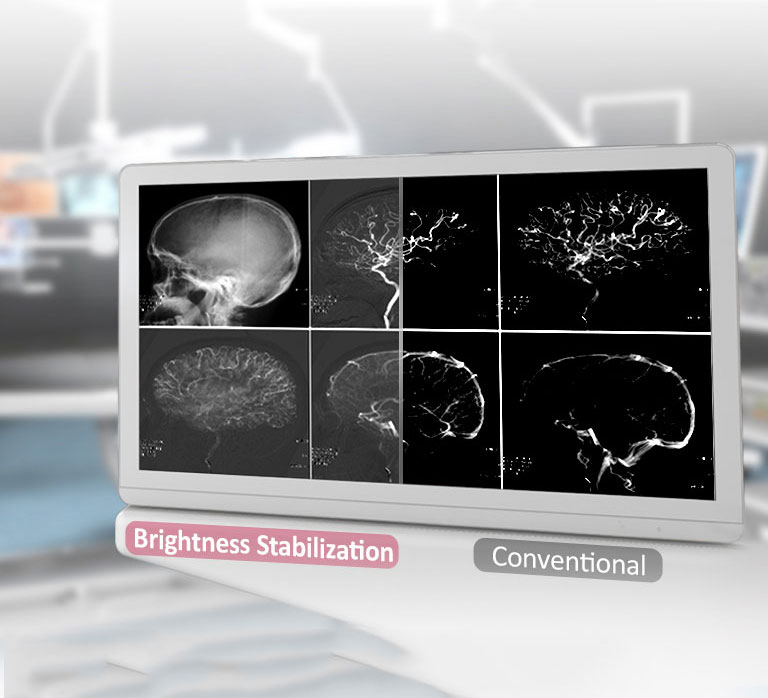  DICOM Part 14 & Brightness Stabilization