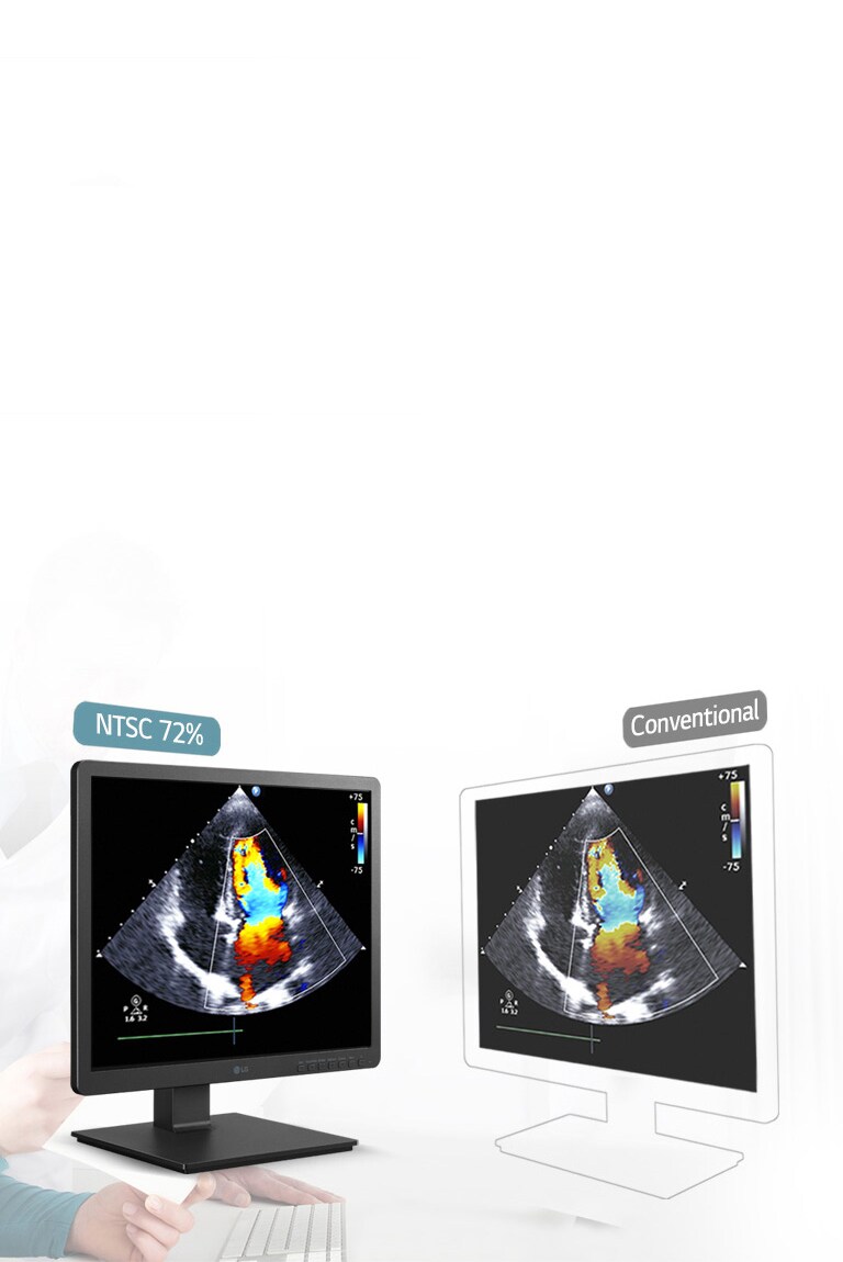 330nits & NTSC 72% Precise Resolution1