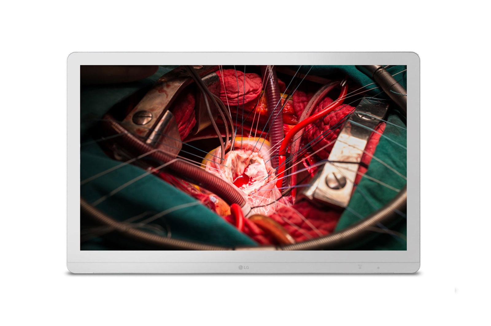 LG 27 (68.58cm) UHD 8MP Surgical Monitor, 27HJ710S-W