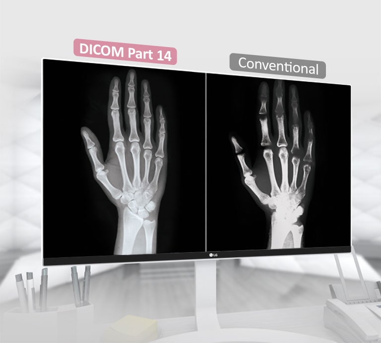 DICOM Part 14