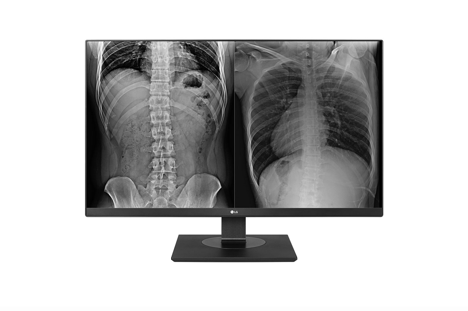 Front view of LG 8MP Clinical Review Monitor 27HJ713C-B