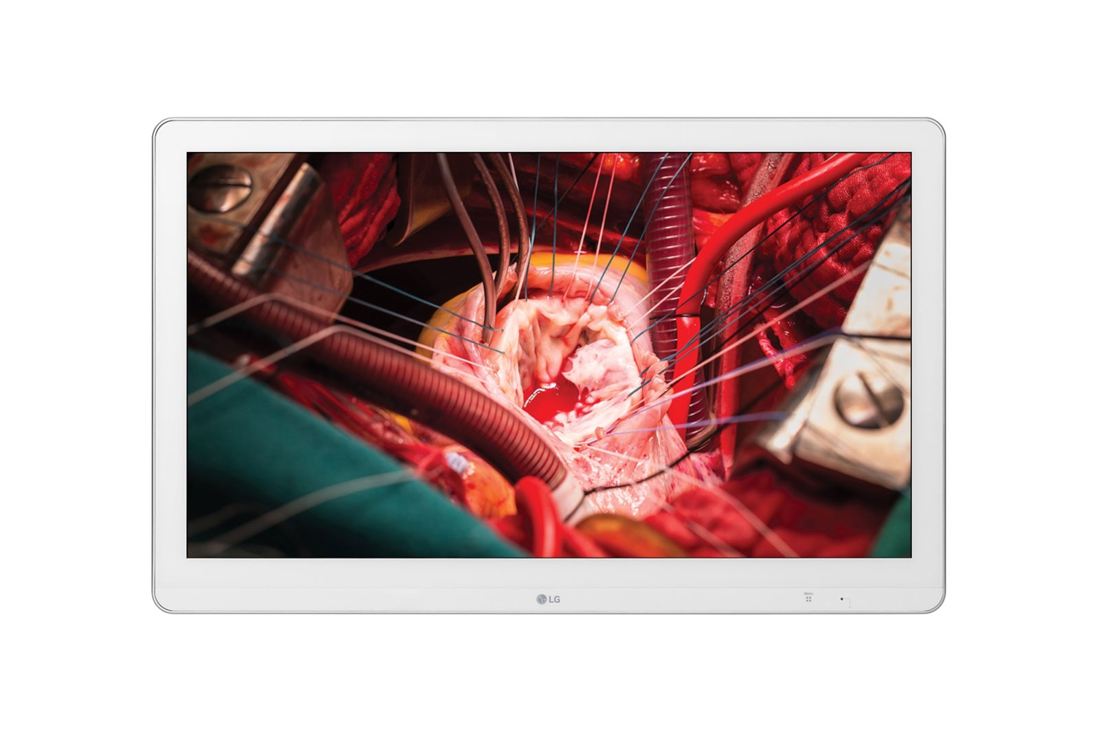 Front view of LG 27 (68.58cm) Full HD Surgical Monitor 27HK510S-W