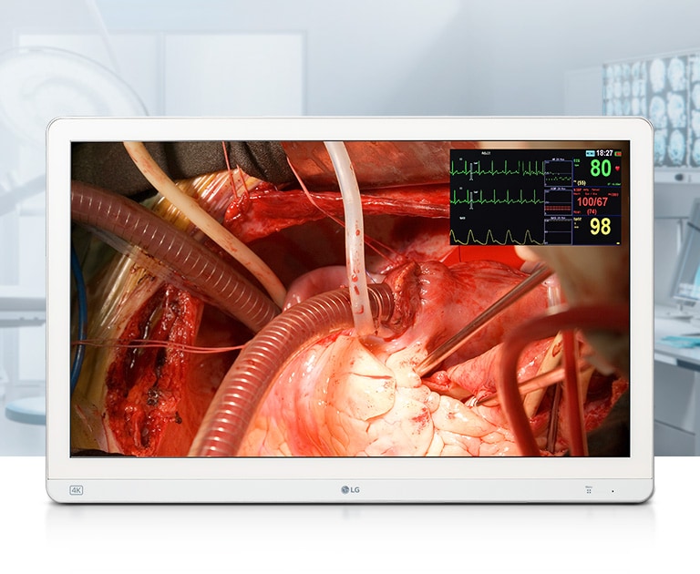 LG 27hq710s-w 27 (68.58cm) 4K Surgical Monitor with Mini-LED