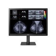 front view with mammography imaging results on the screen 
