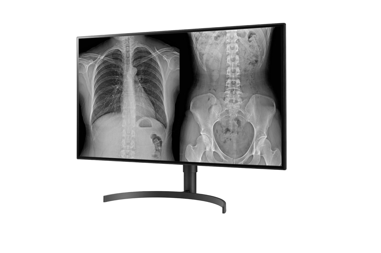 LG 31.5 (80.01cm) UHD 8MP Diagnostic Monitor, 32HL512D-B