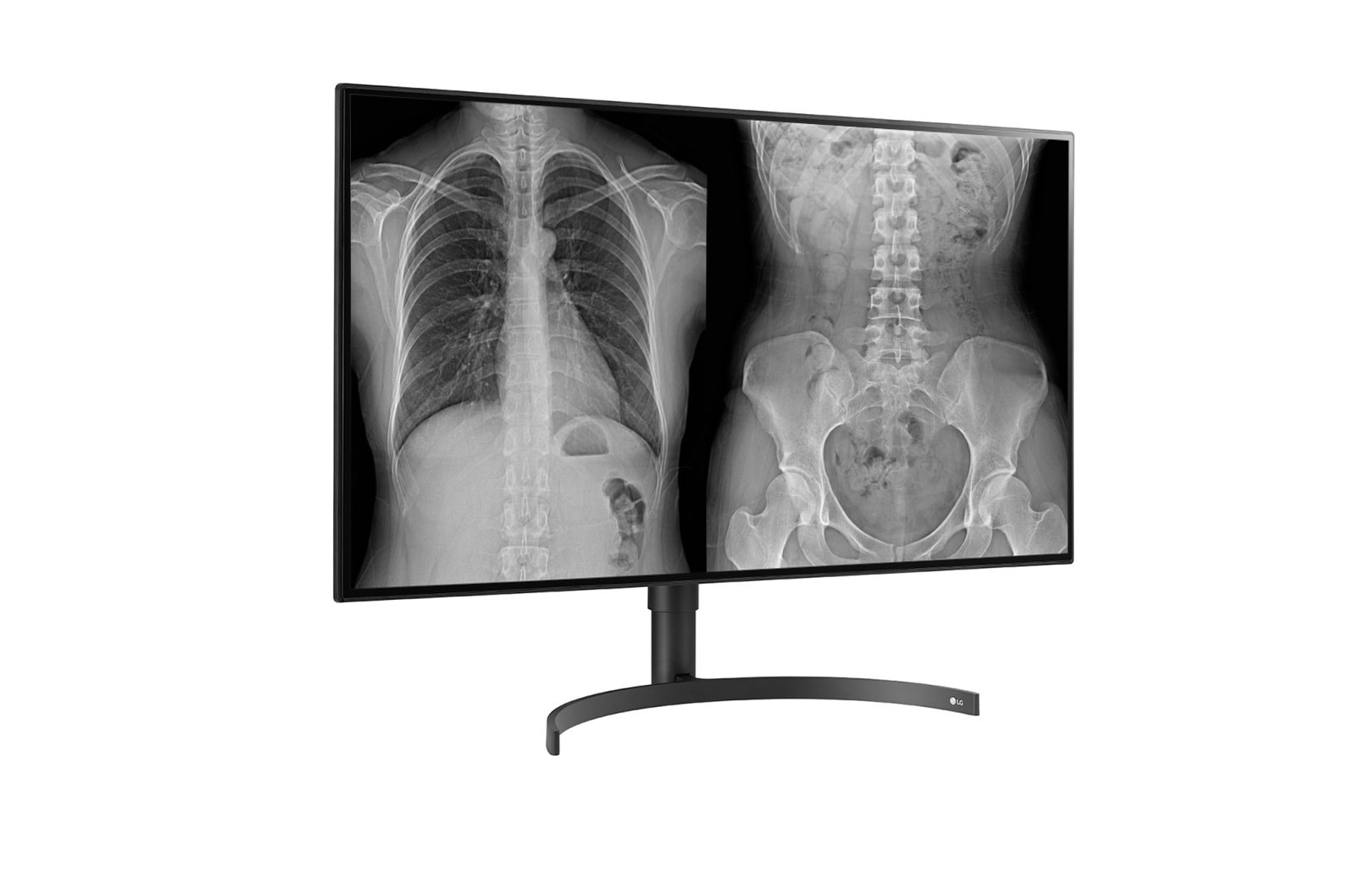 LG 31.5 (80.01cm) UHD 8MP Diagnostic Monitor, 32HL512D-B