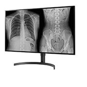LG 31.5 (80.01cm) UHD 8MP Diagnostic Monitor, 32HL512D-B