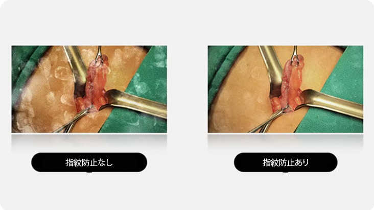 右の画像は指紋防止コーティングが施されており、汚れがなくクリアで、手術部位をよりよく表示いたします。