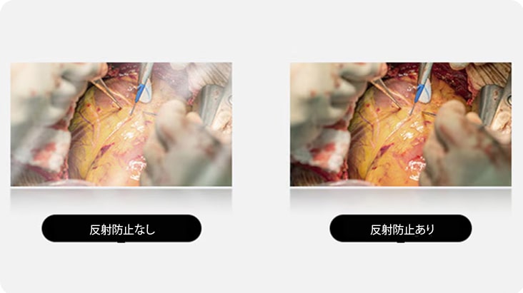 右の画像は反射防止コーティングが施されており、まぶしさが軽減され、より鮮明な視界を提供いたします。