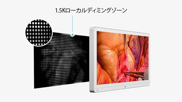 画面に手術画像が表示された医療用モニターと、1.5Kのローカルディミングゾーンを示す図で、エネルギー効率と耐久性を向上させるためのバックライト制御の強化を強調しています。