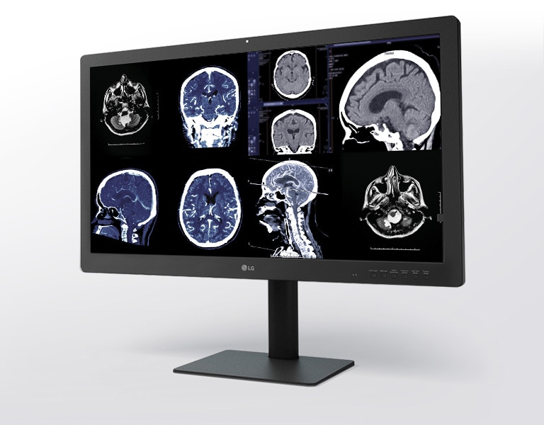 クリアな画像を提供する設計