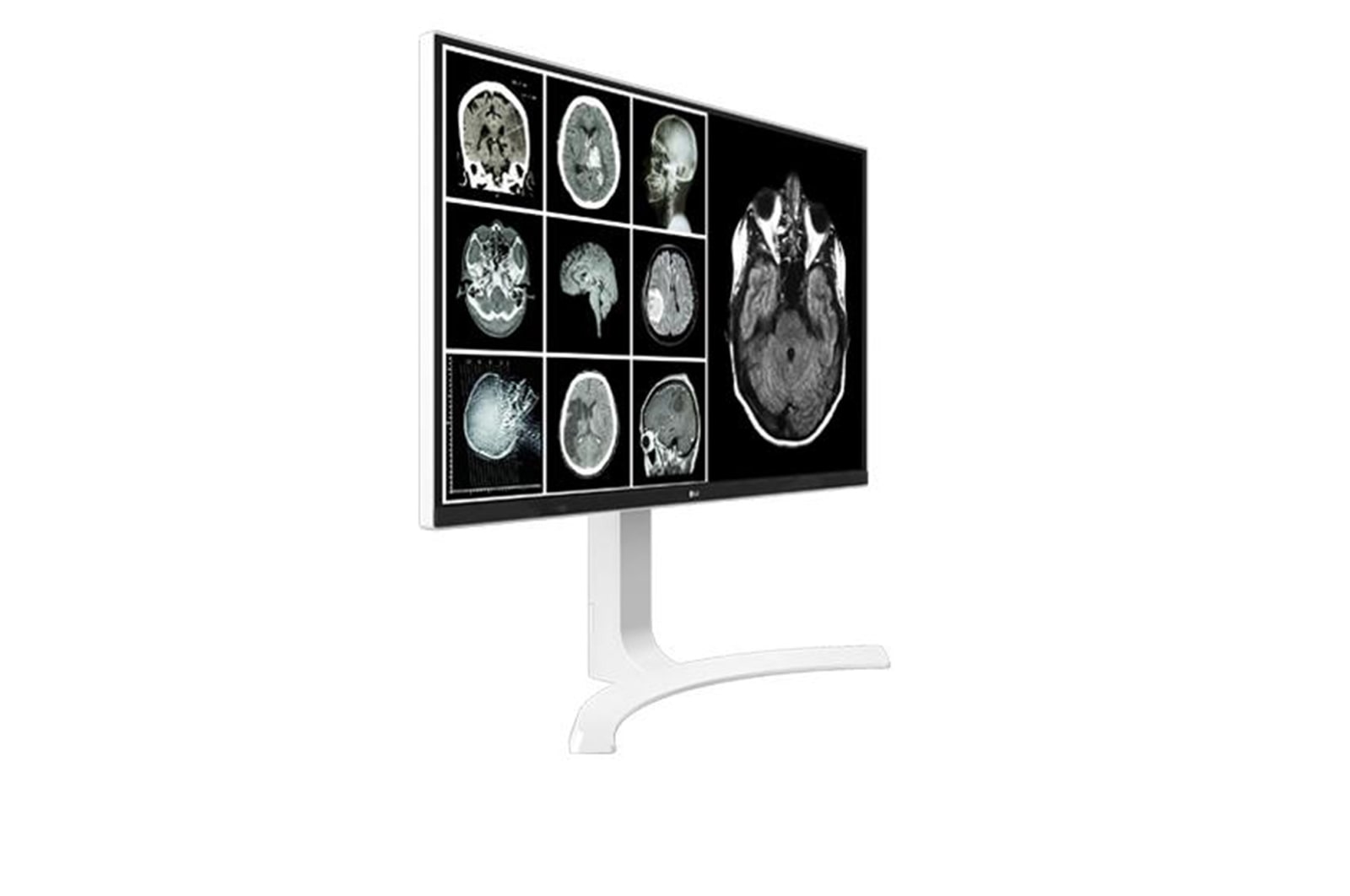 Left side display view