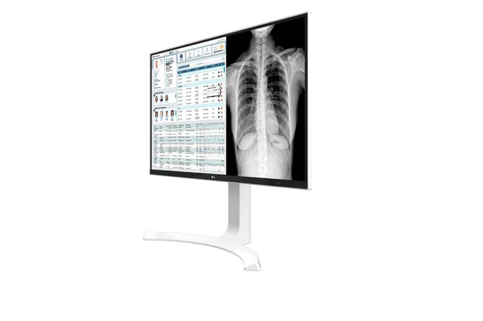Right  side display view