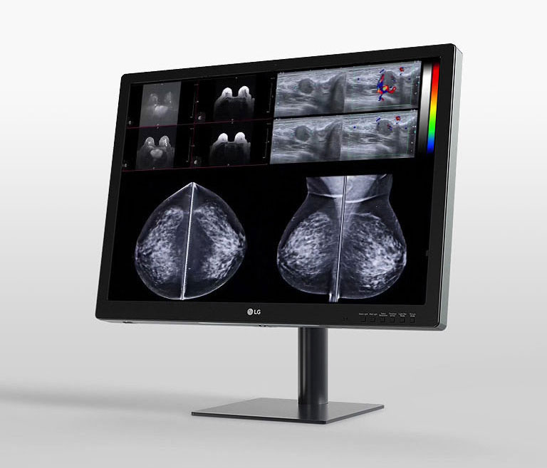 lg 31 inch 12mp ips display designed for breast imaging offering streamlined workflow, and improved comfort
