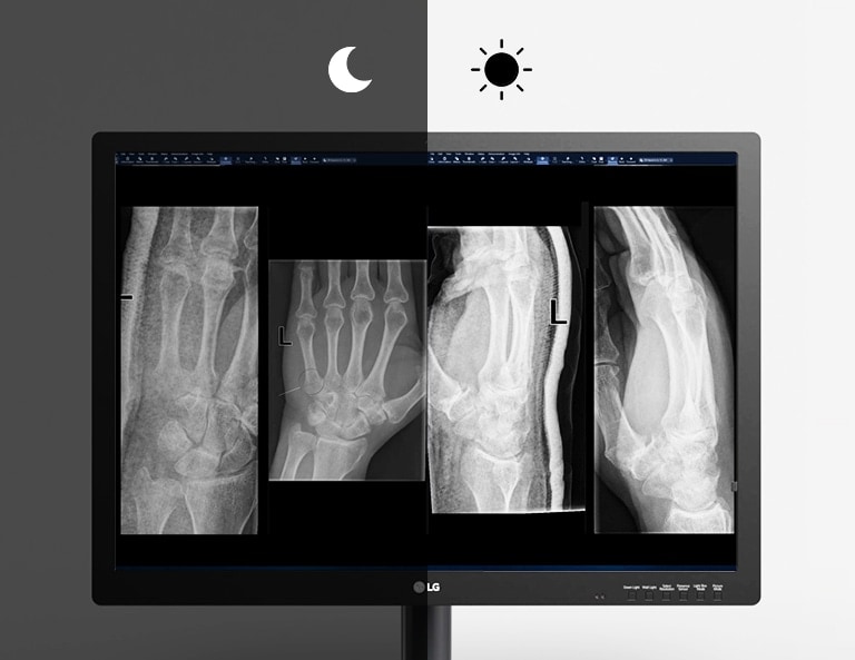 auto luminance sensor offering automatic adjustment of screen brightness at the optimal level under ambient lighting conditions