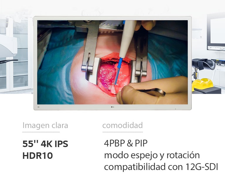 El monitor quirúrgico 4K IPS 55MH5K de LG llevará la calidad de imagen y la comodidad al siguiente nivel.