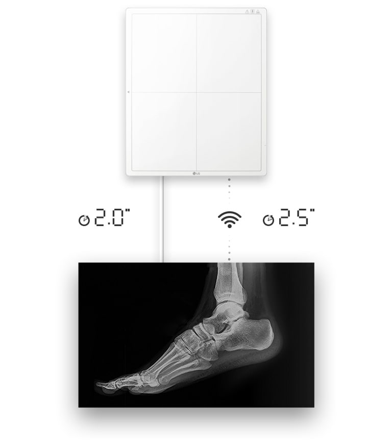 Disponibilidad de la imagen en 2 segundos con una conexión por cable o 2.5 segundos con una conexión inalámbrica para obtener una imagen en bruto