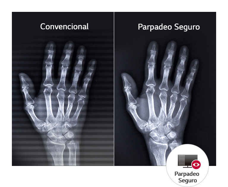 Comodidad Ocular Duradera1