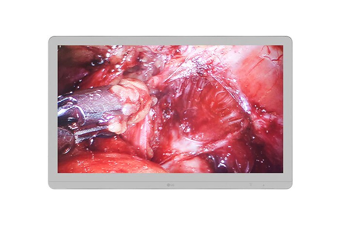 LG 27'' 8MP Chirurgische monitor, 27HJ710S