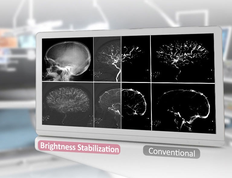 DICOM deel 14 en helderheidsstabilisatie