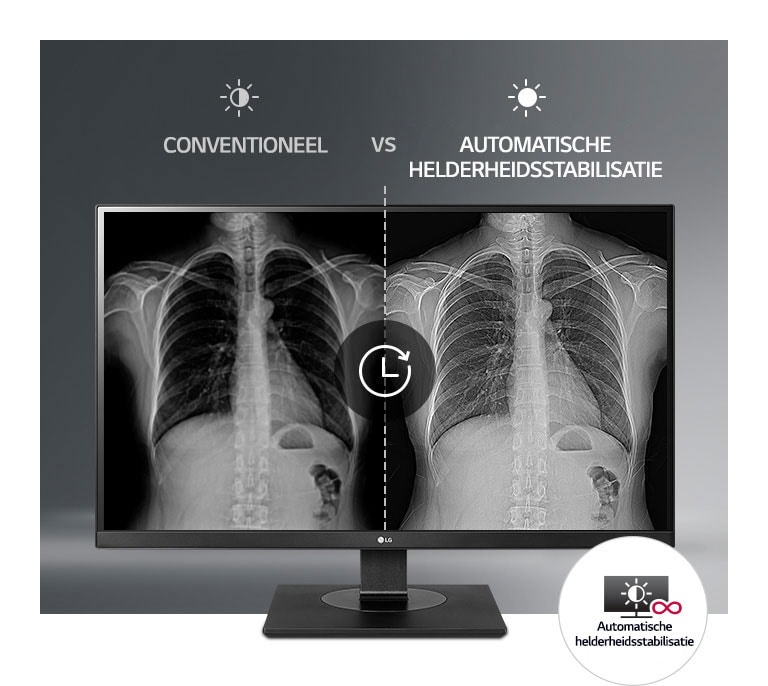 Consequent stabiel beeldscherm