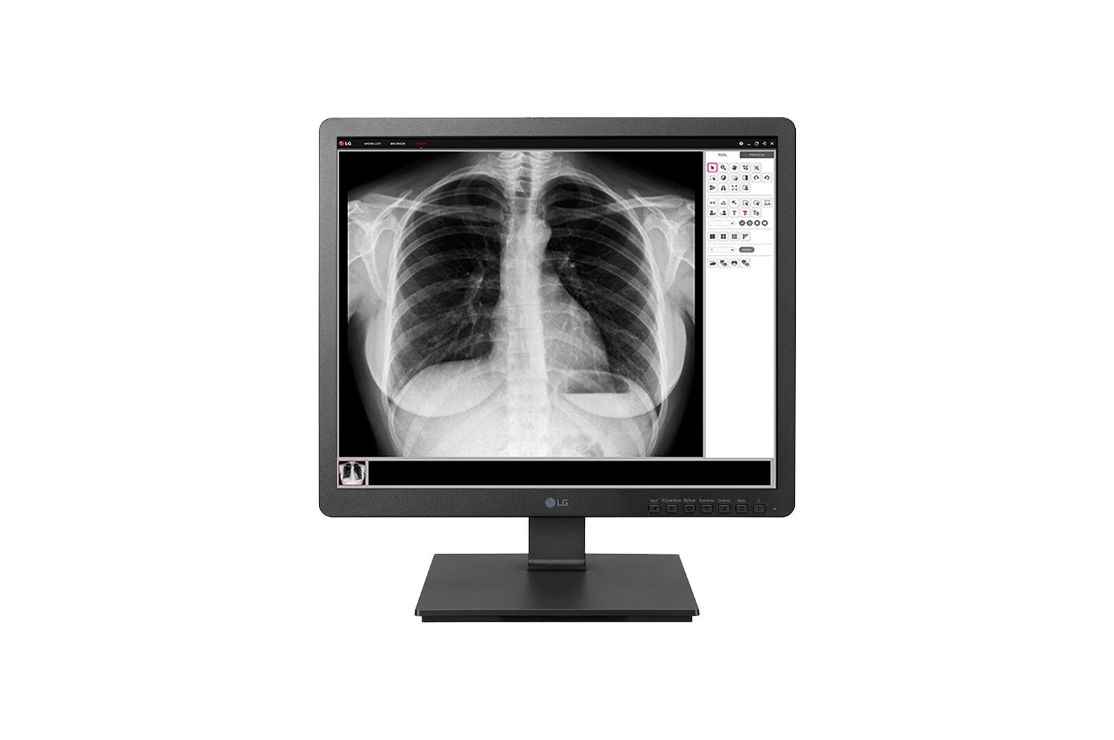 Vooraanzicht van 19 Inch medische monitor 1280 x 1024 19HK312C